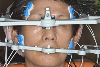顎運動解析検査および筋電図検査